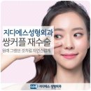 지디에스성형외과