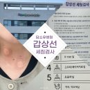 극복일기] ① 서울 강남 학동역 담소유병원 갑상선 초음파, 세침검사 후기 (과정, 비용, 통증), 결과 설명