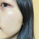 토신 | 피부 진정, 보습 케어에 좋은 피부 구원템! 보떼덤 엘리시어 엑소토신 마스크팩 사용 솔직 후기