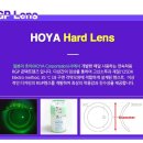 온양밝은안과의원 네이버블로그