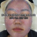 신안동7 | 광주 북구 피부관리 신안동 아임뷰티 미백 색소 집중 케어