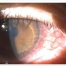 아이소프트 이미지