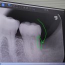 덴탈 케어 시스템 이미지