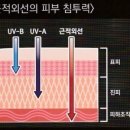 글라시스트
