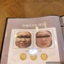 청주 피부관리/청주 웨딩케어 추천 ㅣ 청주 비안에스테틱에서 작은얼굴 관리 받고 왔어요~(찐 솔직후기)