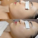 유샵뷰티 | 용산 남영역피부관리 유샵뷰티 수분케어와 하이푸로 리프팅 효과 높이기