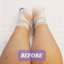 웰 하우스 | 통증 개선, 체형 교정 전문, 마포 공덕역 웰카이로모션