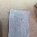 피지오닉스 네이버블로그