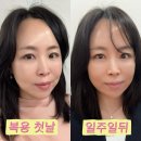 365생생한의원 | 동탄 다이어트 8체질 진맥 내돈내산 한의원 식이조절 후기