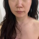 금환 | 🙌 신림경락 난곡 피부관리 &lt;도영 에스테틱&gt; 난곡에스테틱 후기 💆‍♀️ 금환테라피까지?!