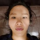 온한의원 | 분당안면비대칭교정, 소리나는 턱관절 교정한의원 상담하고 온 후기