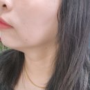 식품의약품안전청 | 부산 성형외과 텐트리플 고현정리프팅 솔직 후기