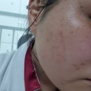 오일스팟 네이버블로그