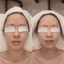 압구정에스테틱 스파유 SPA Uㅣ웨딩관리 진심으로 만족도 10000% 찐후기