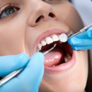 네오치과의원 | 설명이 이렇게 친절할 일인가요? 부천 청담네오치과 후기