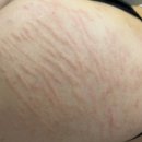 스킨52부천지부 이미지