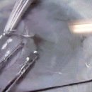 서울성모안과병원 이미지