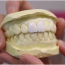 심미치과기공소 이미지