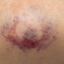 유진하나로약국 이미지