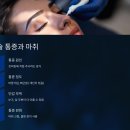 리쥬란 힐러 효과와 부작용 | PN 성분·통증·시술 주기 완전 정리