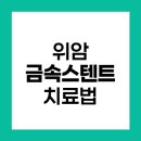 중앙유도관 | 위암 환자의 금속 스텐트 삽입술 실패 원인과 대처법