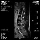 엠알아이 이미지