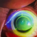 아이닥터안경 이미지