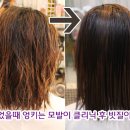 지우헤어클리닉