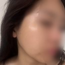 매탄동위브하늘채 115동앞 버스정류장 | 💖 수원 피부관리샵 ‘더스킨’ 솔직후기｜물광피부 + 상체 림프관리 받고 꿀잠 잔 날