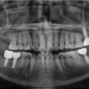 진플란트치과의원 이미지