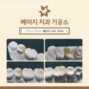 금천치과기공소 이미지