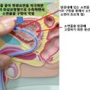 소변줄 가지고 있으면 방광이 자극받아서 바지를 적실수도 있어요. 이미지