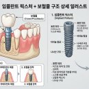 란치과기공소 이미지