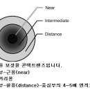 Re:노안 수술아닌 렌즈? 이미지