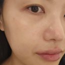 용인 피부샵 베누아에스테틱에서 피부관리 해본 진짜 후기