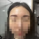 한양의원 | 강남 자연스러운 반영구 눈썹 &#39;드보라의원&#39; 내돈내산 후기