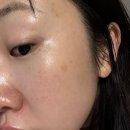 닥터이레이저피부과의원 | [내돈내산] 듀얼레이저토닝 닥터이레이저피부과의원