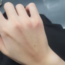 나사렛 | 나사렛종합병원 응급실 후기