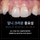 수영치과 앞니 임시치아 크라운 비용 잇몸 중요성