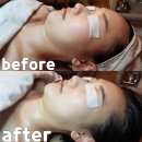 라비에 에스테틱 이미지