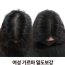 라이모플러스(LYMOPLUS) 이미지