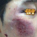 압구정리치모아의원 이미지