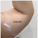 킴앤리소아청소년과이비인후과의원 | 평택 이충동 서울아산연합의원에서 쥐젖 제거한 후기