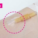 알파메디케어 네이버블로그