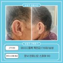 굿모닝 보청기 옥천점 | 보청기 가격 비교,이XX고객님 포낙 인피니오 스피어 90 구매후기(70대,男)