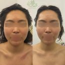 뷰티 몽 이미지