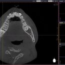 서울아산플란트치과의원 이미지