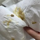 안일전자 | [혐 주의] 전자담배 안끊고 부비동염(축농증) 완치 후기
