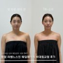 NR-3[송파대로]-하-145 | 문정역 에스테틱 '라헨느스킨' 웨딩패키지 신부비대칭관리 내돈내산 후기