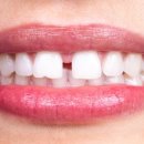 서울엘치과의원 이미지